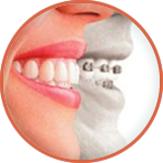 Ortodoncia y Ortopedia Maxilar